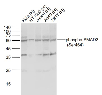 Phospho-SMAD2 (Ser464) Rabbit Polyclonal Antibody
