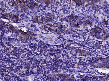 CD46 Recombinant Rabbit Monoclonal Antibody