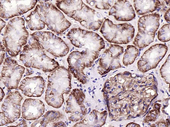 CD46 Recombinant Rabbit Monoclonal Antibody