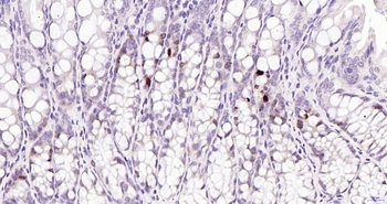 Phospho-JNK1/2/3 (T183+T183+T221) Recombinant Rabbit Monoclonal Antibody