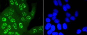 Phospho-JNK1/2/3 (T183+T183+T221) Recombinant Rabbit Monoclonal Antibody