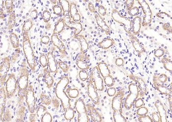 Phospho-JNK1/2/3 (T183+T183+T221) Recombinant Rabbit Monoclonal Antibody