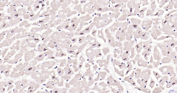 Phospho-JNK1/2/3 (T183+T183+T221) Recombinant Rabbit Monoclonal Antibody
