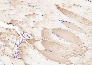 Phospho-CDKN1B (Ser178) Rabbit Polyclonal Antibody