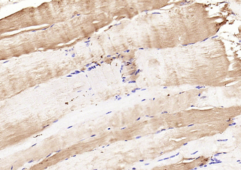 Phospho-CDKN1B (Ser178) Rabbit Polyclonal Antibody