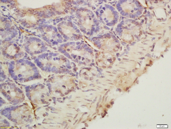 Phospho-CDKN1B (Ser178) Rabbit Polyclonal Antibody