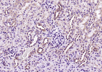 SLC15A1 Rabbit Polyclonal Antibody
