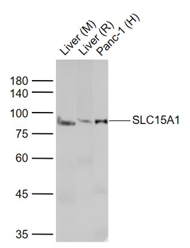 SLC15A1 Rabbit Polyclonal Antibody