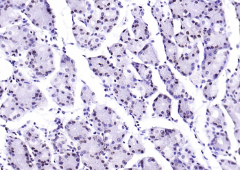 Phospho-SIRT1 (Ser47) Recombinant Rabbit Monoclonal Antibody