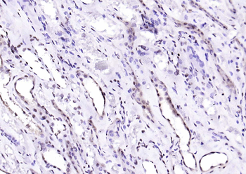 Phospho-SIRT1 (Ser47) Recombinant Rabbit Monoclonal Antibody