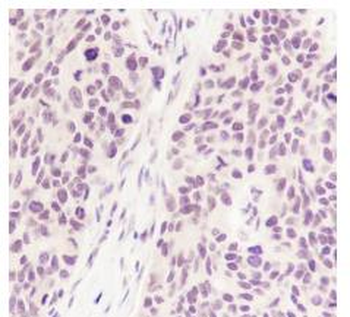 Phospho-SIRT1 (Ser47) Recombinant Rabbit Monoclonal Antibody