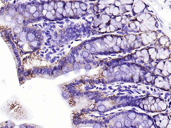 Integrin alpha 2 Recombinant Rabbit Monoclonal Antibody