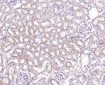 Integrin alpha 2 Recombinant Rabbit Monoclonal Antibody