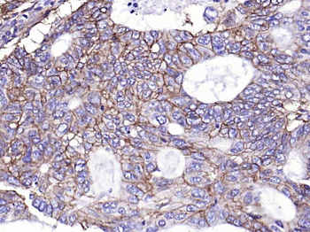 Integrin alpha 2 Recombinant Rabbit Monoclonal Antibody