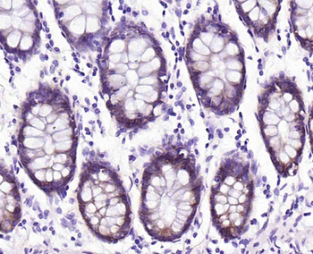 Integrin alpha 2 Recombinant Rabbit Monoclonal Antibody