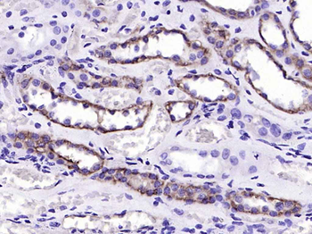 Integrin alpha 2 Recombinant Rabbit Monoclonal Antibody