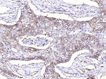 Integrin alpha 2 Recombinant Rabbit Monoclonal Antibody