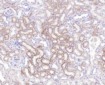 Integrin alpha 2 Recombinant Rabbit Monoclonal Antibody