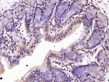 ERK1/2 Recombinant Rabbit Monoclonal Antibody