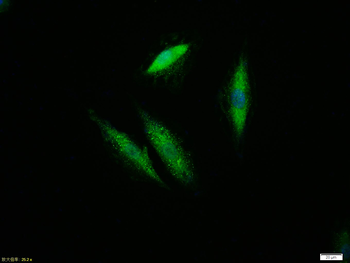 ERK1/2 Recombinant Rabbit Monoclonal Antibody