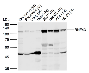 RNF43 Rabbit Polyclonal Antibody