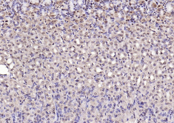 UBE2Q1 Rabbit Polyclonal Antibody