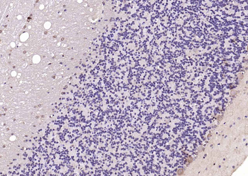 UBE2Q1 Rabbit Polyclonal Antibody