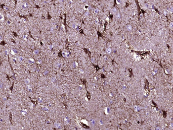 Galectin 3 Mouse Monoclonal Antibody