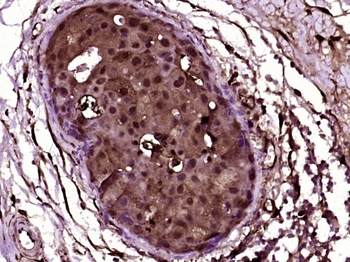 Galectin 3 Mouse Monoclonal Antibody
