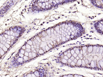 Galectin 3 Mouse Monoclonal Antibody