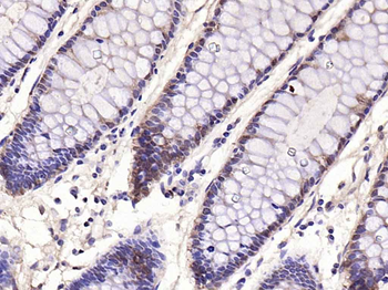 Galectin 3 Mouse Monoclonal Antibody