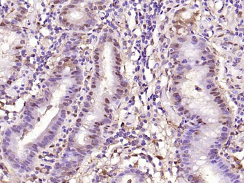 Galectin 3 Mouse Monoclonal Antibody