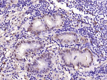 Galectin 3 Mouse Monoclonal Antibody