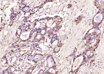 Galectin 3 Mouse Monoclonal Antibody