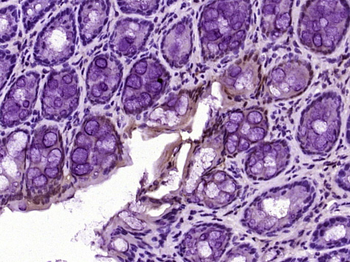 Galectin 3 Mouse Monoclonal Antibody