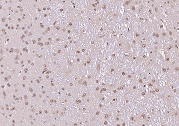LSM3 Rabbit Polyclonal Antibody