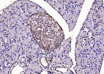 LSM3 Rabbit Polyclonal Antibody