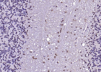 LSM3 Rabbit Polyclonal Antibody