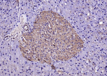 LSM3 Rabbit Polyclonal Antibody