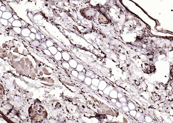 LSM3 Rabbit Polyclonal Antibody