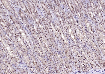 LSM3 Rabbit Polyclonal Antibody