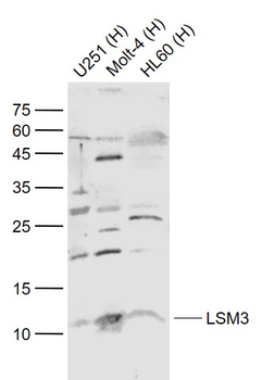 LSM3 Rabbit Polyclonal Antibody