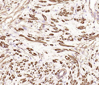 Alpha smooth muscle Actin Recombinant Rabbit Monoclonal Antibody