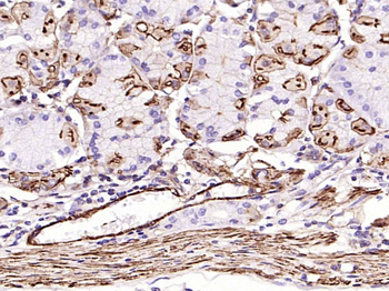 Alpha smooth muscle Actin Recombinant Rabbit Monoclonal Antibody