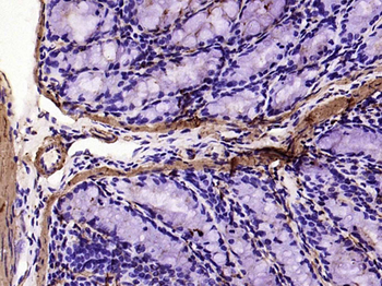Alpha smooth muscle Actin Recombinant Rabbit Monoclonal Antibody