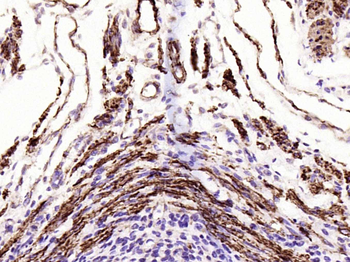 Alpha smooth muscle Actin Recombinant Rabbit Monoclonal Antibody