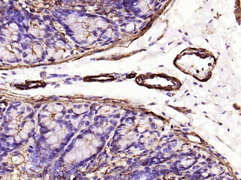 Alpha smooth muscle Actin Recombinant Rabbit Monoclonal Antibody