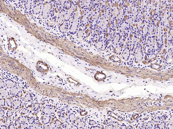 Alpha smooth muscle Actin Recombinant Rabbit Monoclonal Antibody