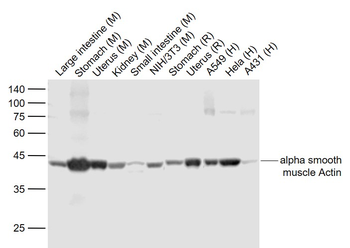 Alpha smooth muscle Actin Recombinant Rabbit Monoclonal Antibody