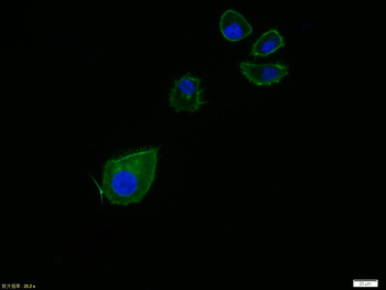 Alpha smooth muscle Actin Recombinant Rabbit Monoclonal Antibody